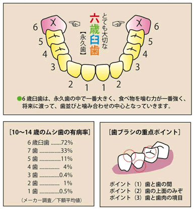 >6歳臼歯（永久歯）